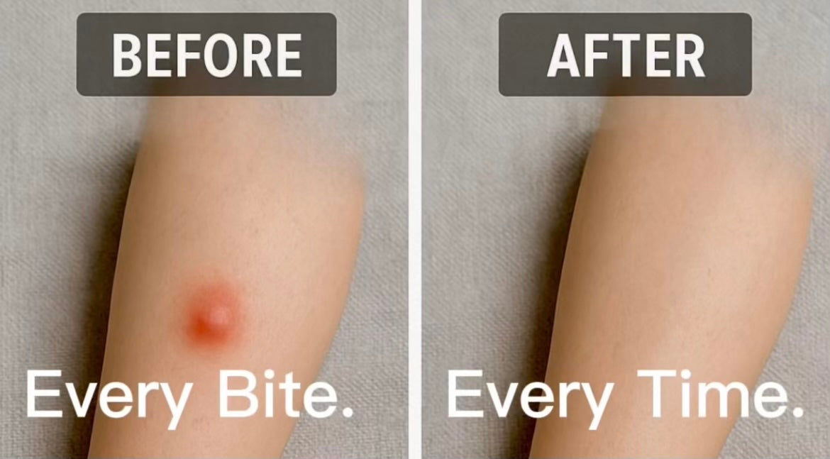 Dr. Kojian's Anti-Itch Insect Ointment