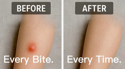 Dr. Kojian's Anti-Itch Insect Ointment